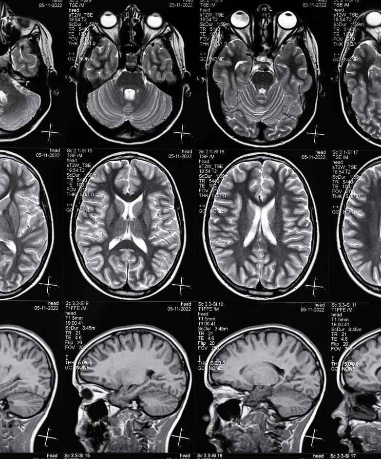 Head & Brain Injury